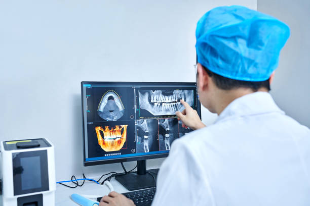 Best Knocked-Out Tooth (Avulsed Tooth) Treatment in Henderson, TN